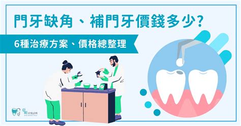 牙齒門牙|門牙缺角、補門牙價錢要多少？6 種治療方案、價格總。